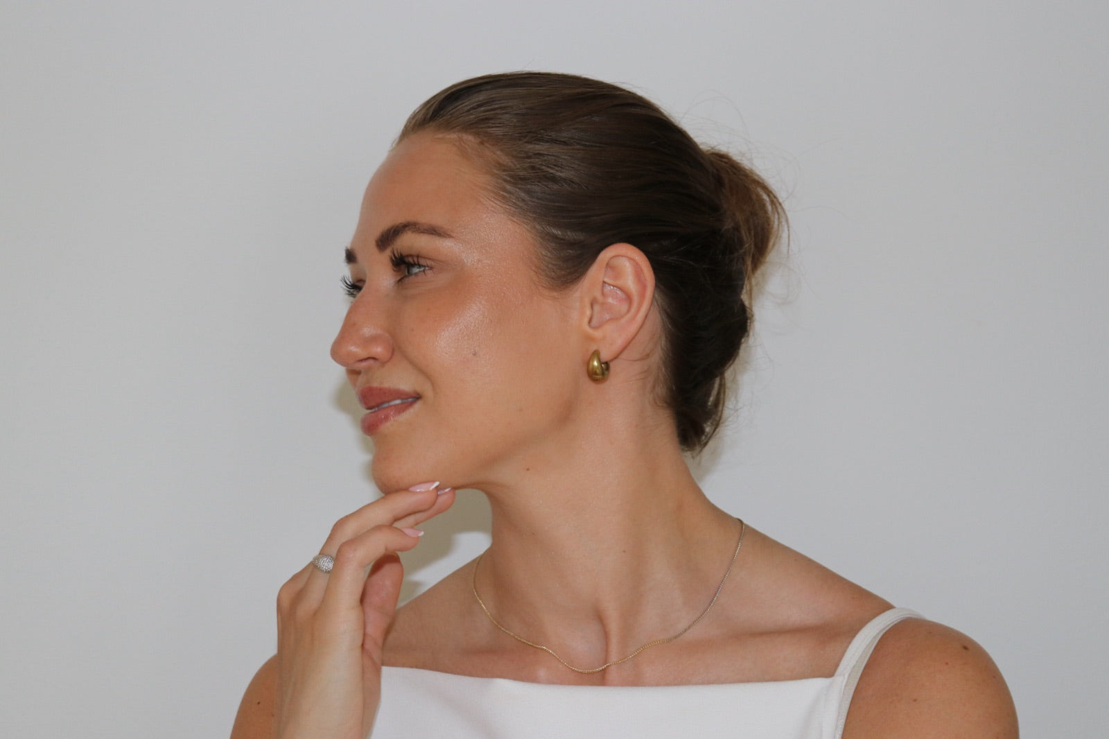 Botox mod tandkødssmil (gummy smile)